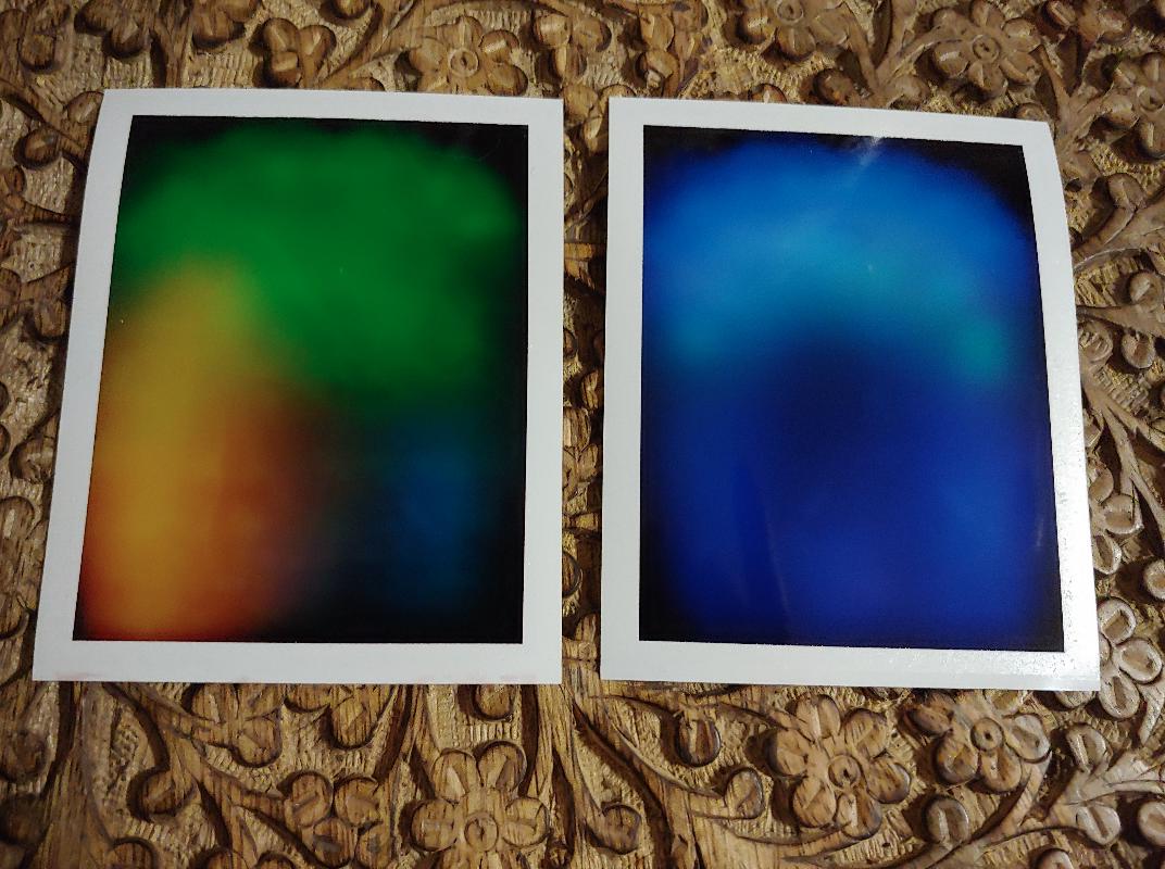 before and after tx 1